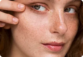 Skin Brightening & Pigmentation